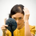 Iron-Deficiency Anemia and Hair Loss: Causes, Prevention, and Treatment