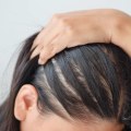 Hairstyles for Thinning Hair: Solutions for Male and Female Hair Loss