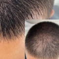 A Guide to Scalp Camouflage Techniques for Hair Loss Solutions