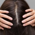 Scalp Treatments for Hair Growth: Everything You Need to Know