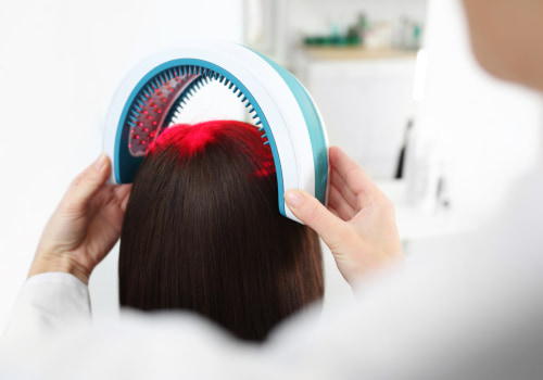 Low-Level Laser Therapy: The Solution to Hair Loss