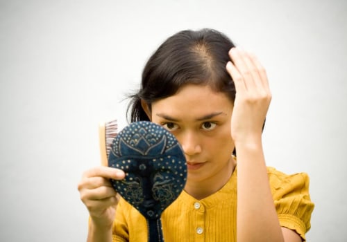 Iron-Deficiency Anemia and Hair Loss: Causes, Prevention, and Treatment