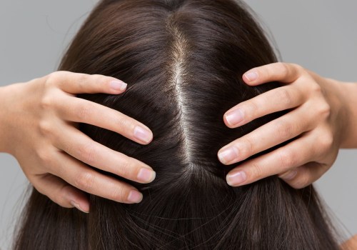 Scalp Treatments for Hair Growth: Everything You Need to Know